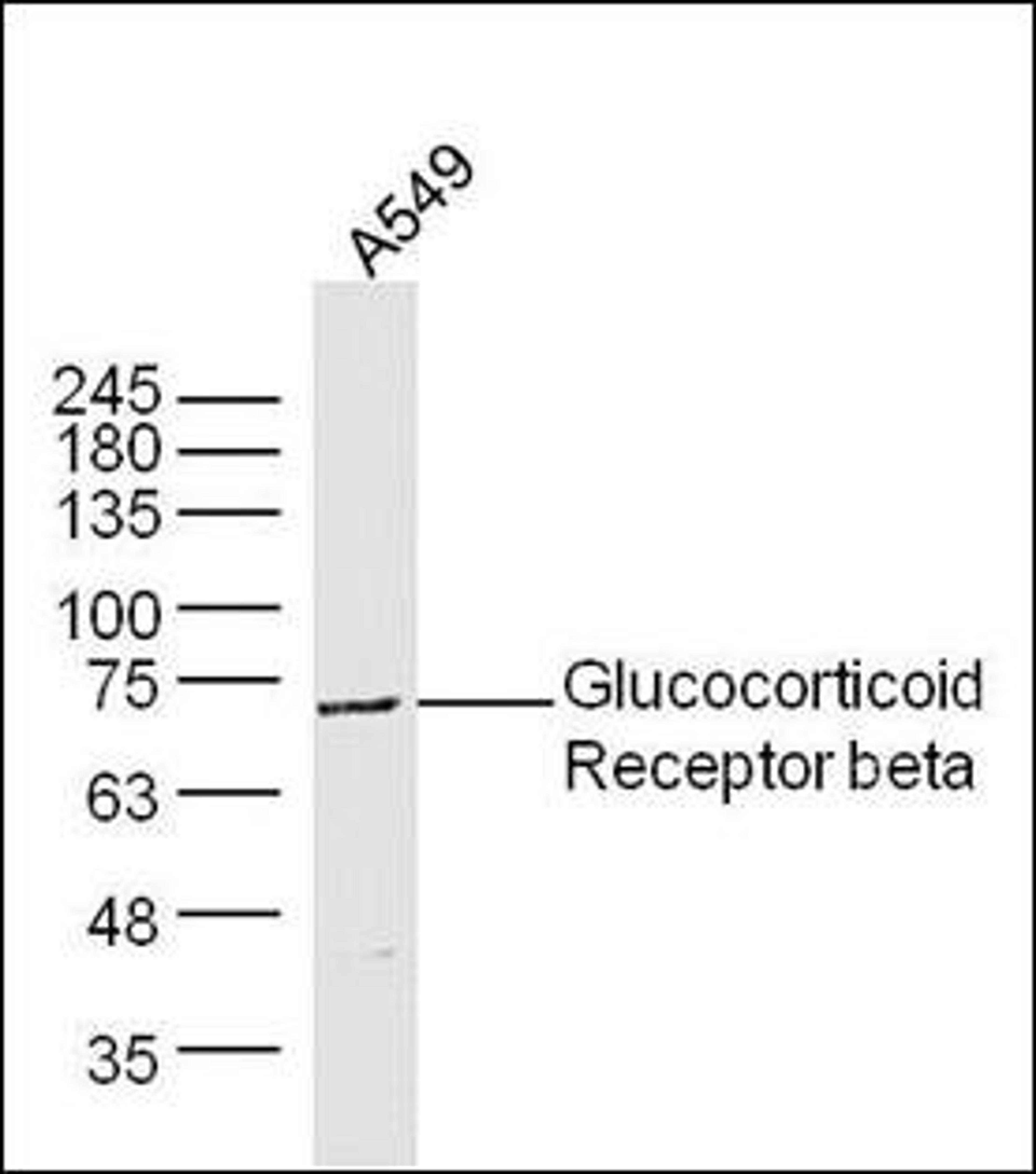 Western blot analysis of extracts from A549 cells using Glucocorticoid Receptor beta antibody.