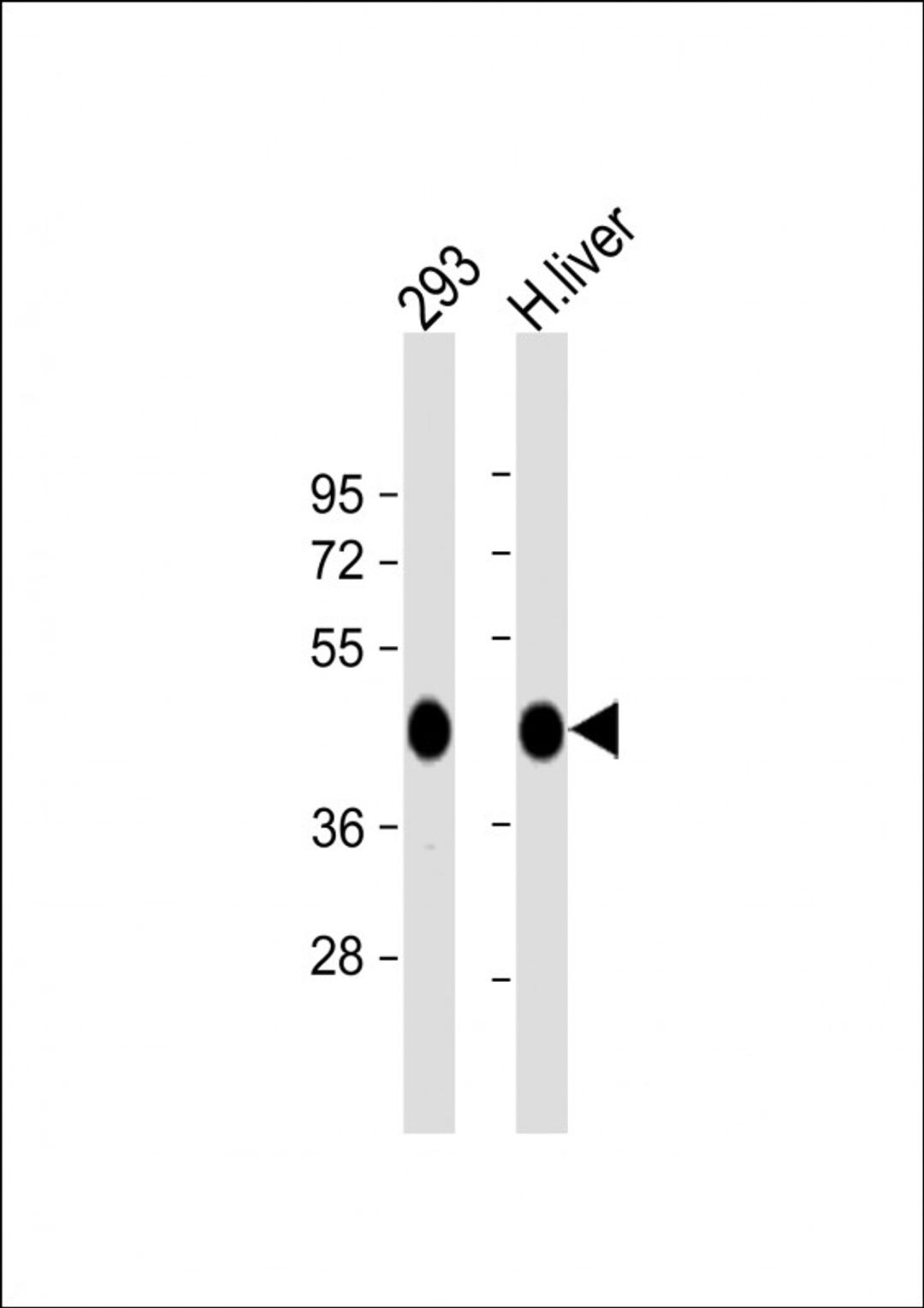 Western Blot at 1:1000 dilution Lane 1: 293 whole cell lysate Lane 2: human liver lysate Lysates/proteins at 20 ug per lane.