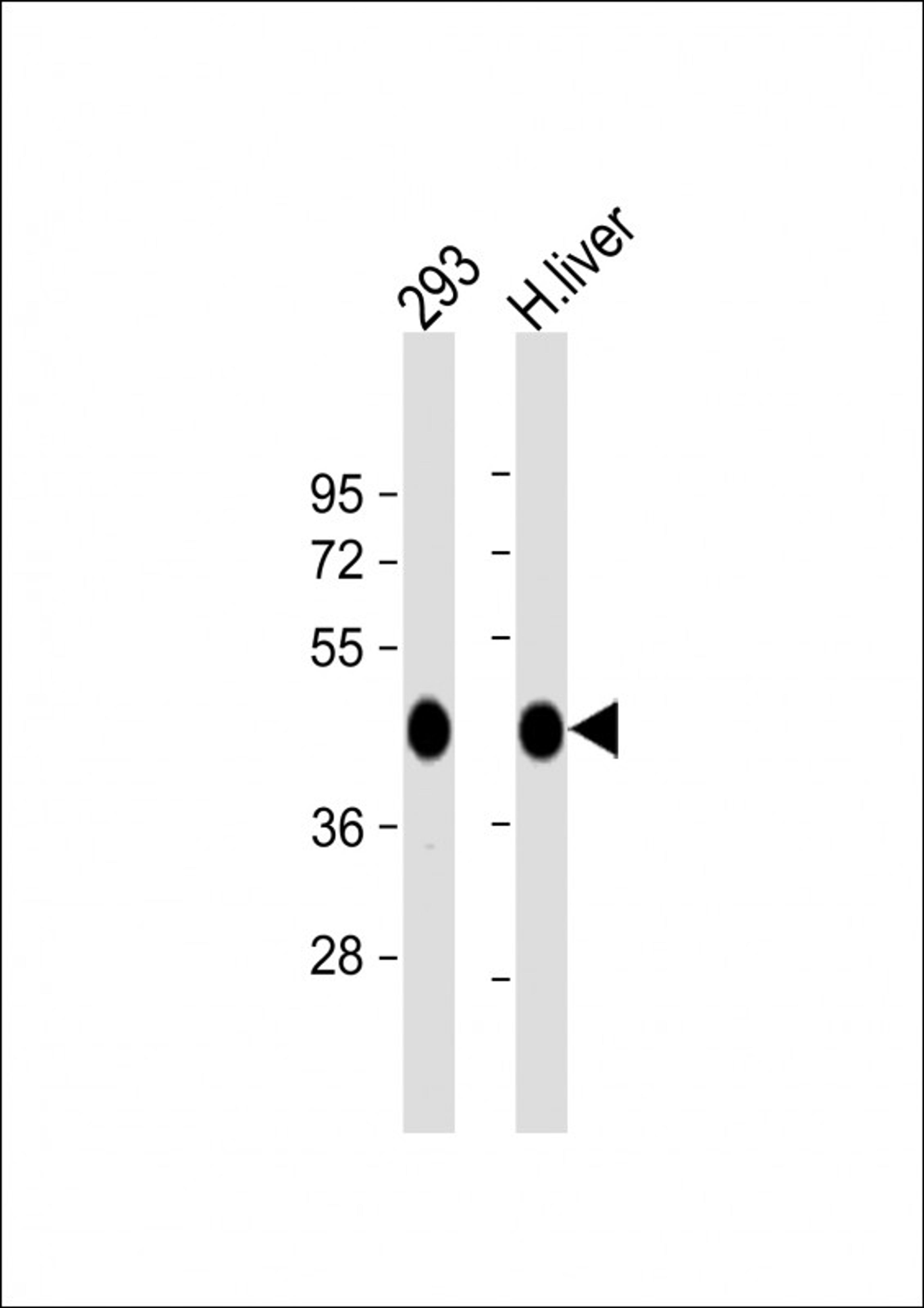 Western Blot at 1:1000 dilution Lane 1: 293 whole cell lysate Lane 2: human liver lysate Lysates/proteins at 20 ug per lane.