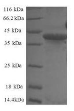 (Tris-Glycine gel) Discontinuous SDS-PAGE (reduced) with 5% enrichment gel and 15% separation gel.