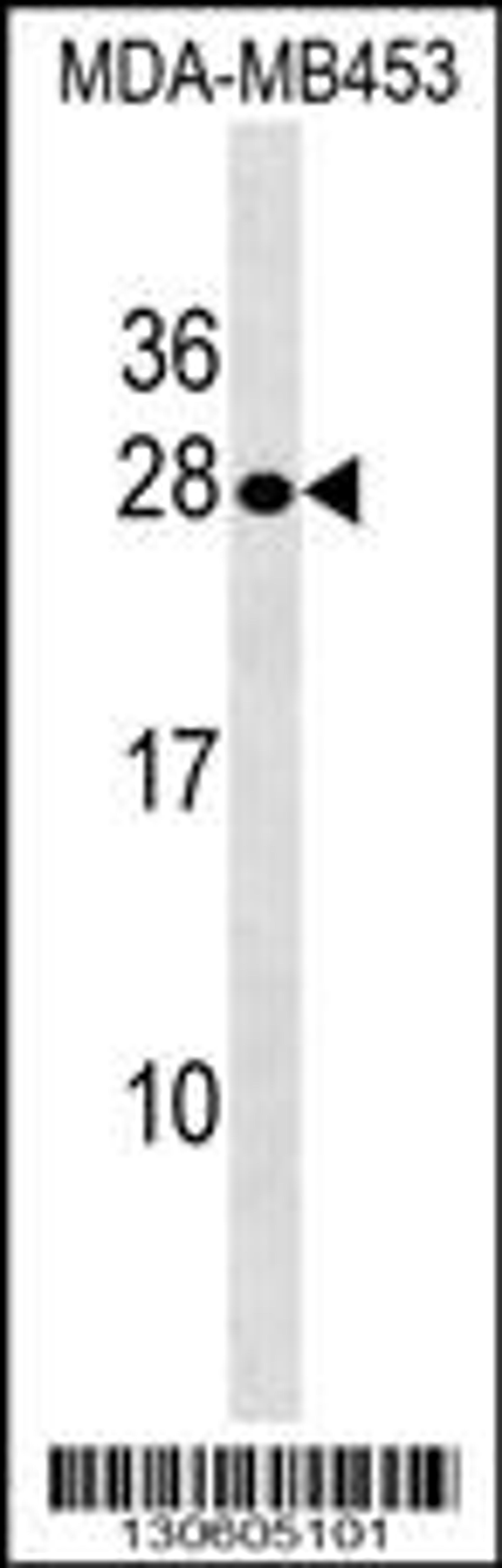 Western blot analysis in MDA-MB453 cell line lysates (35ug/lane).