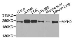 Western blot analysis of extracts of various cells using Myosin IIa antibody