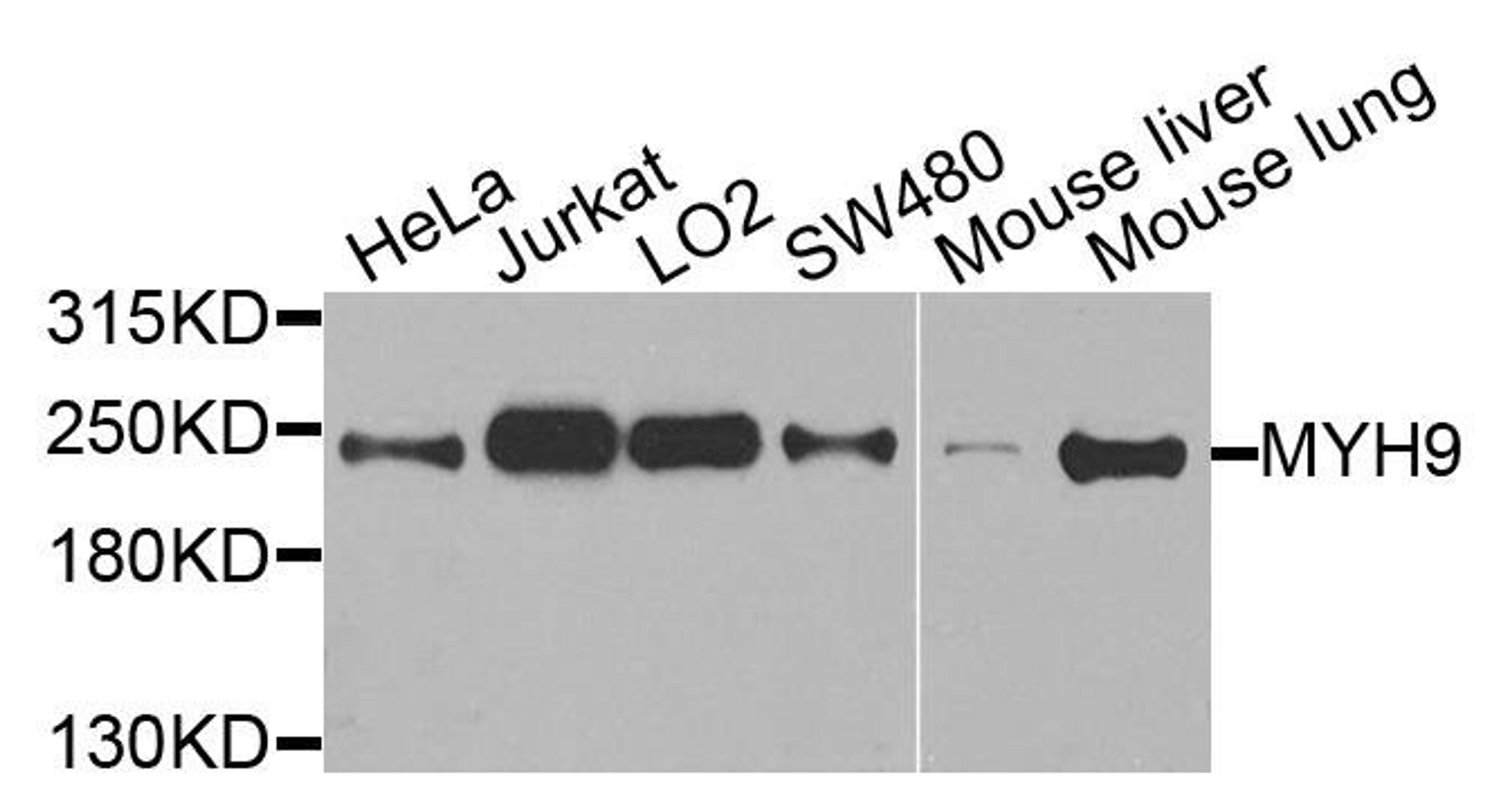 Western blot analysis of extracts of various cells using Myosin IIa antibody