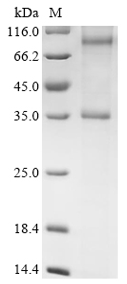 (Tris-Glycine gel) Discontinuous SDS-PAGE (reduced) with 5% enrichment gel and 15% separation gel.