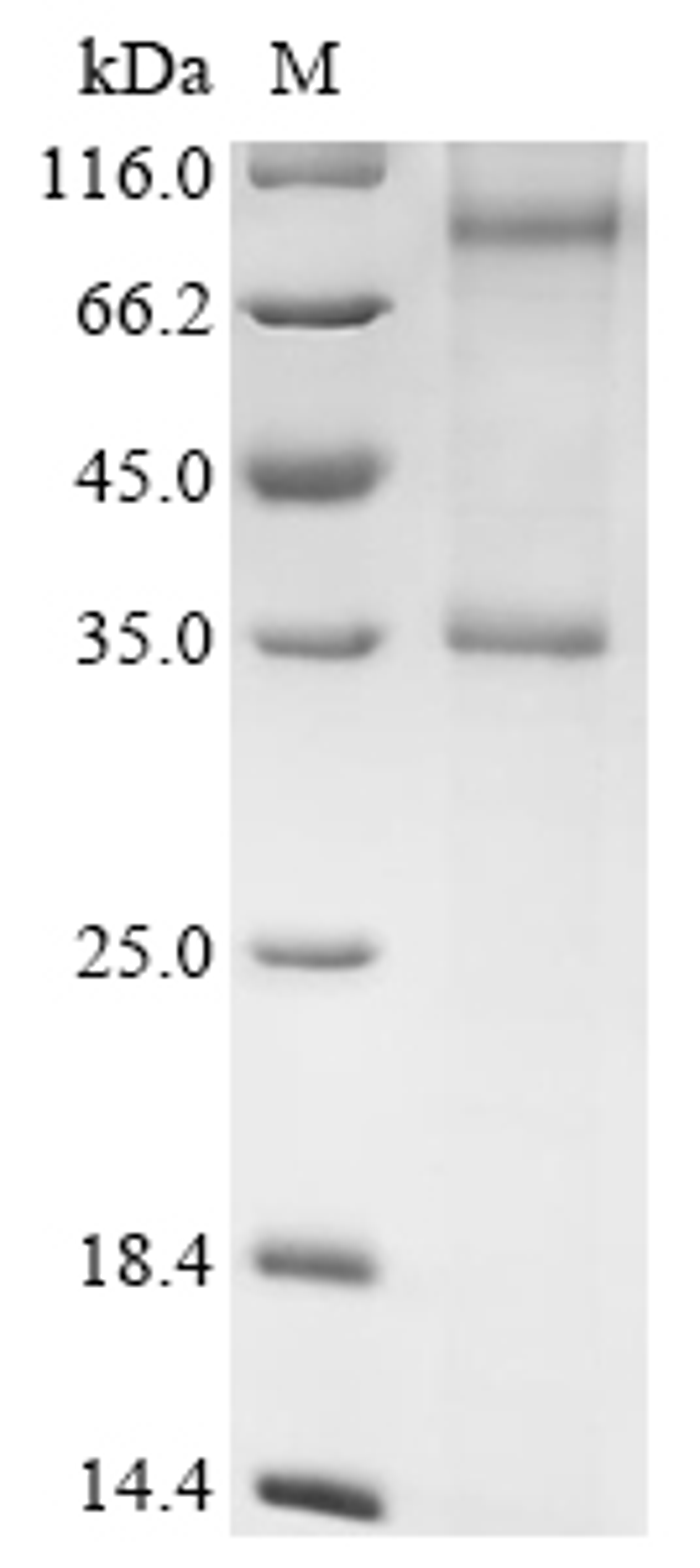 (Tris-Glycine gel) Discontinuous SDS-PAGE (reduced) with 5% enrichment gel and 15% separation gel.
