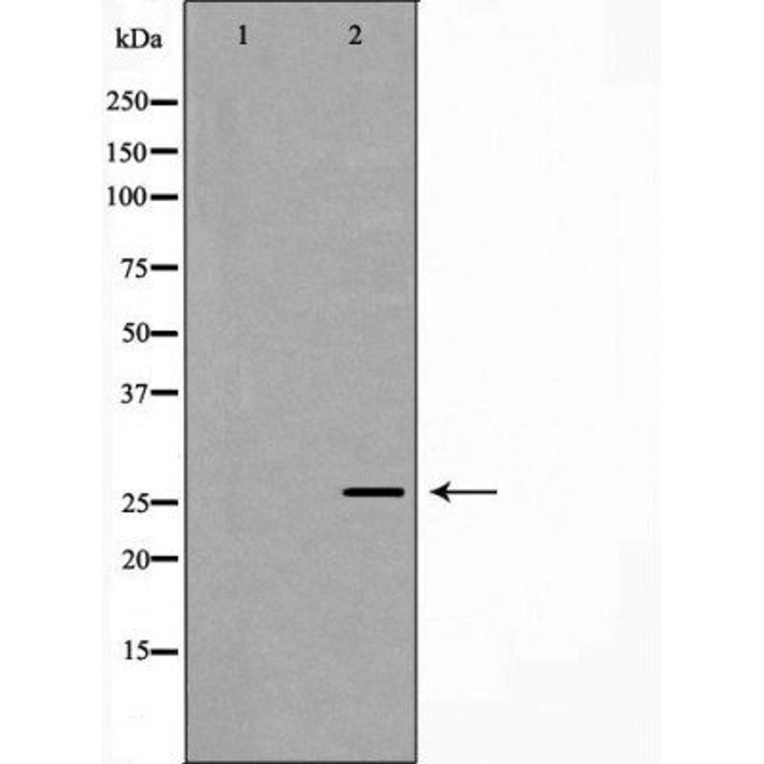 Western blot analysis of recombinant protein using Rabl2 antibody