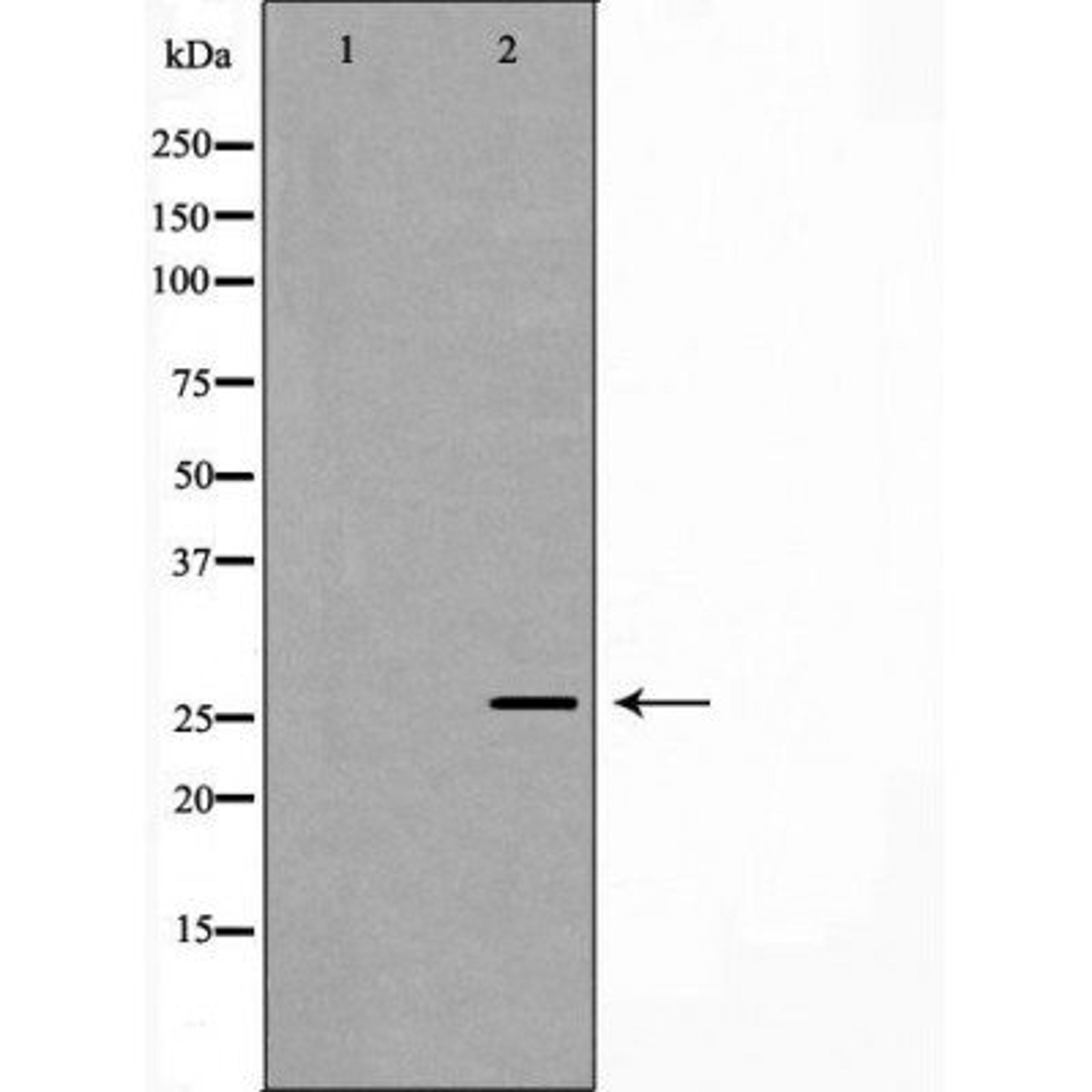 Western blot analysis of recombinant protein using Rabl2 antibody