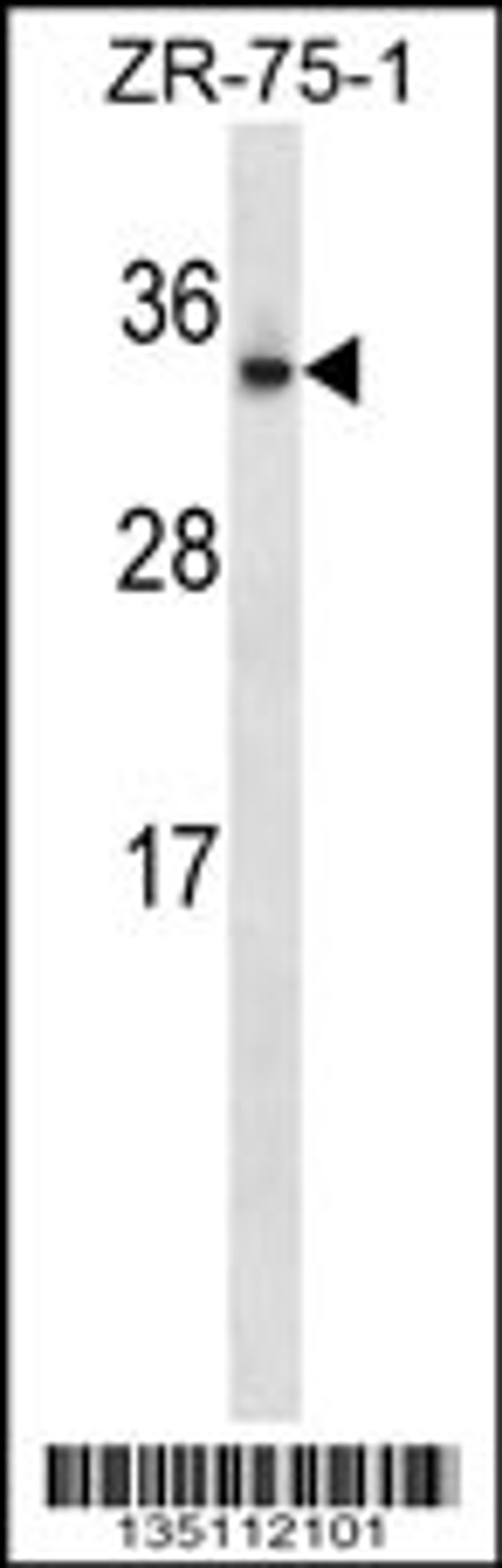 Western blot analysis in ZR-75-1 cell line lysates (35ug/lane).