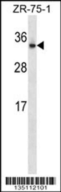 Western blot analysis in ZR-75-1 cell line lysates (35ug/lane).
