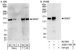 Detection of human and mouse SMG7 by western blot (h&m) and immunoprecipitation (h).