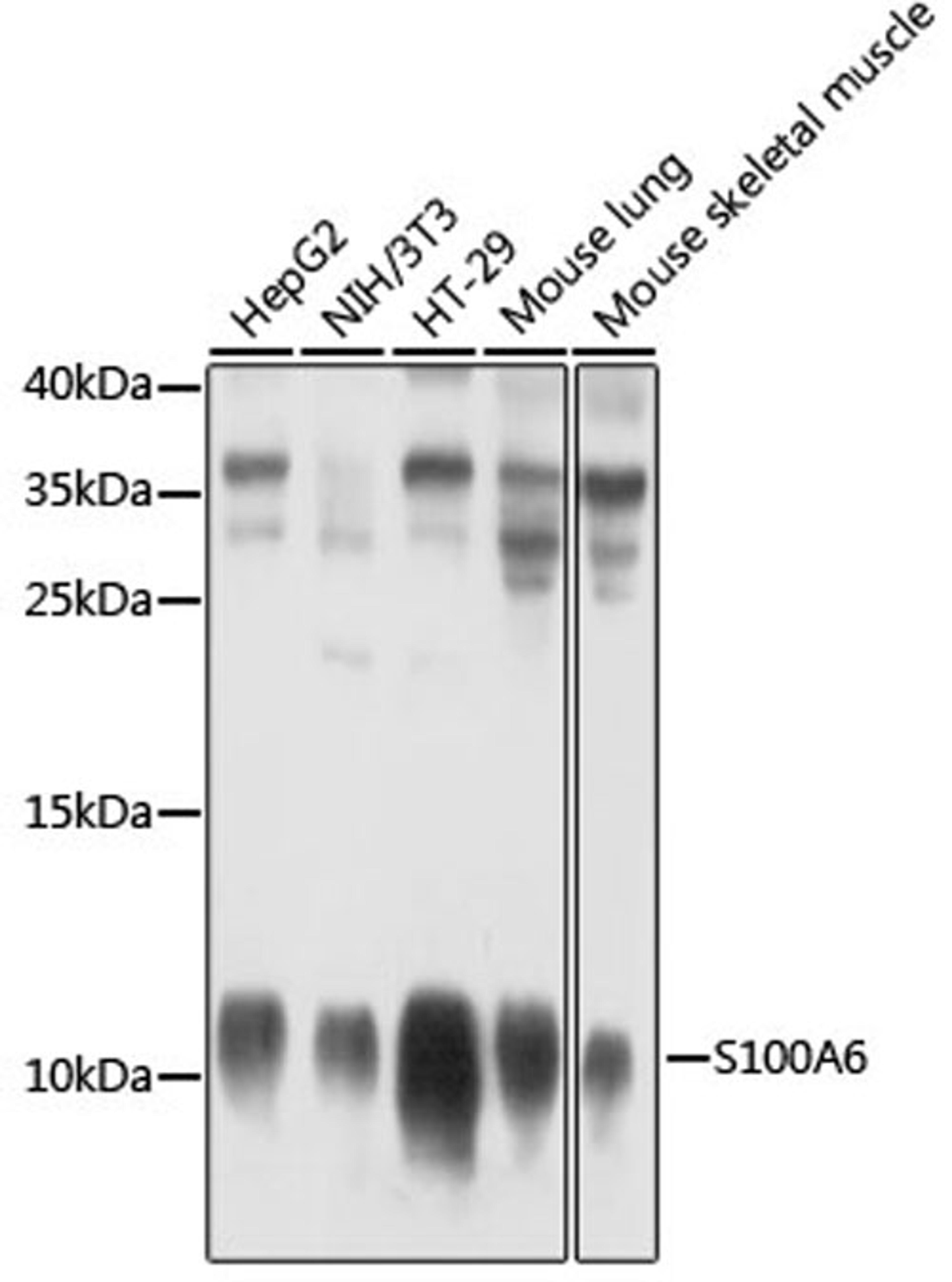 Western blot - S100A6 antibody (A4104)