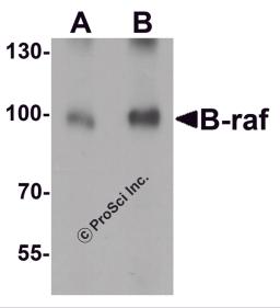 Western blot analysis of B-raf in human brain tissue lysate with B-raf antibody at (A) 1 and (B) 2 &#956;g/mL.