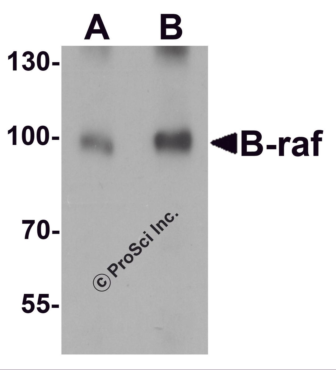 Western blot analysis of B-raf in human brain tissue lysate with B-raf antibody at (A) 1 and (B) 2 μg/mL.