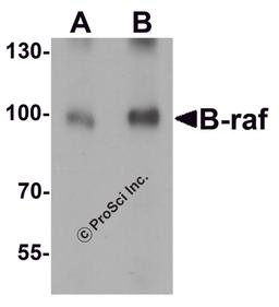 Western blot analysis of B-raf in human brain tissue lysate with B-raf antibody at (A) 1 and (B) 2 μg/mL.