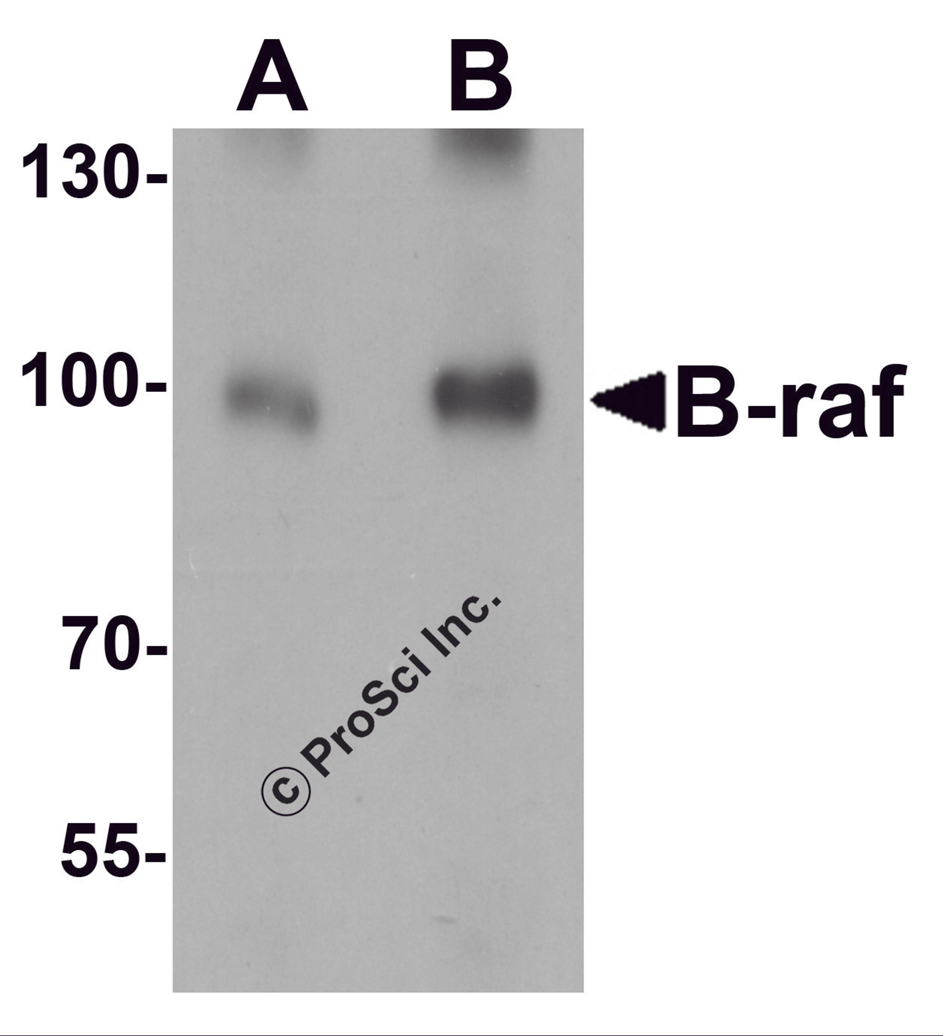 Western blot analysis of B-raf in human brain tissue lysate with B-raf antibody at (A) 1 and (B) 2 μg/mL.