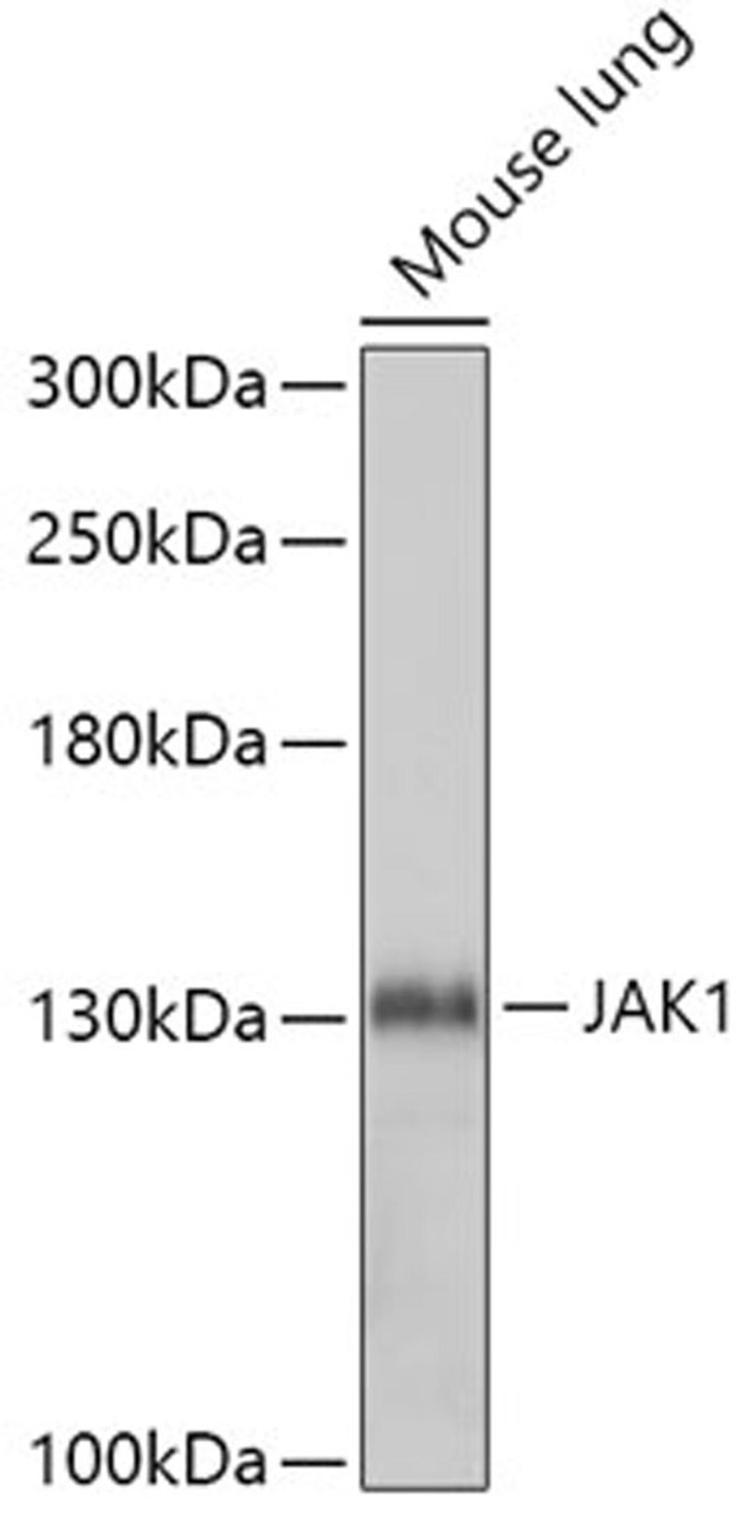 Western blot - JAK1 antibody (A5534)