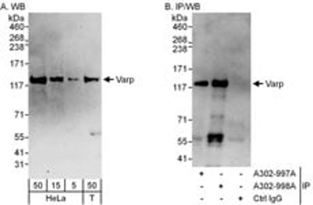 Detection of human Varp by western blot and immunoprecipitation.