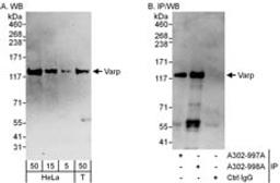 Detection of human Varp by western blot and immunoprecipitation.