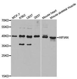 Western blot analysis of extracts of various cell lines using HIF1AN antibody