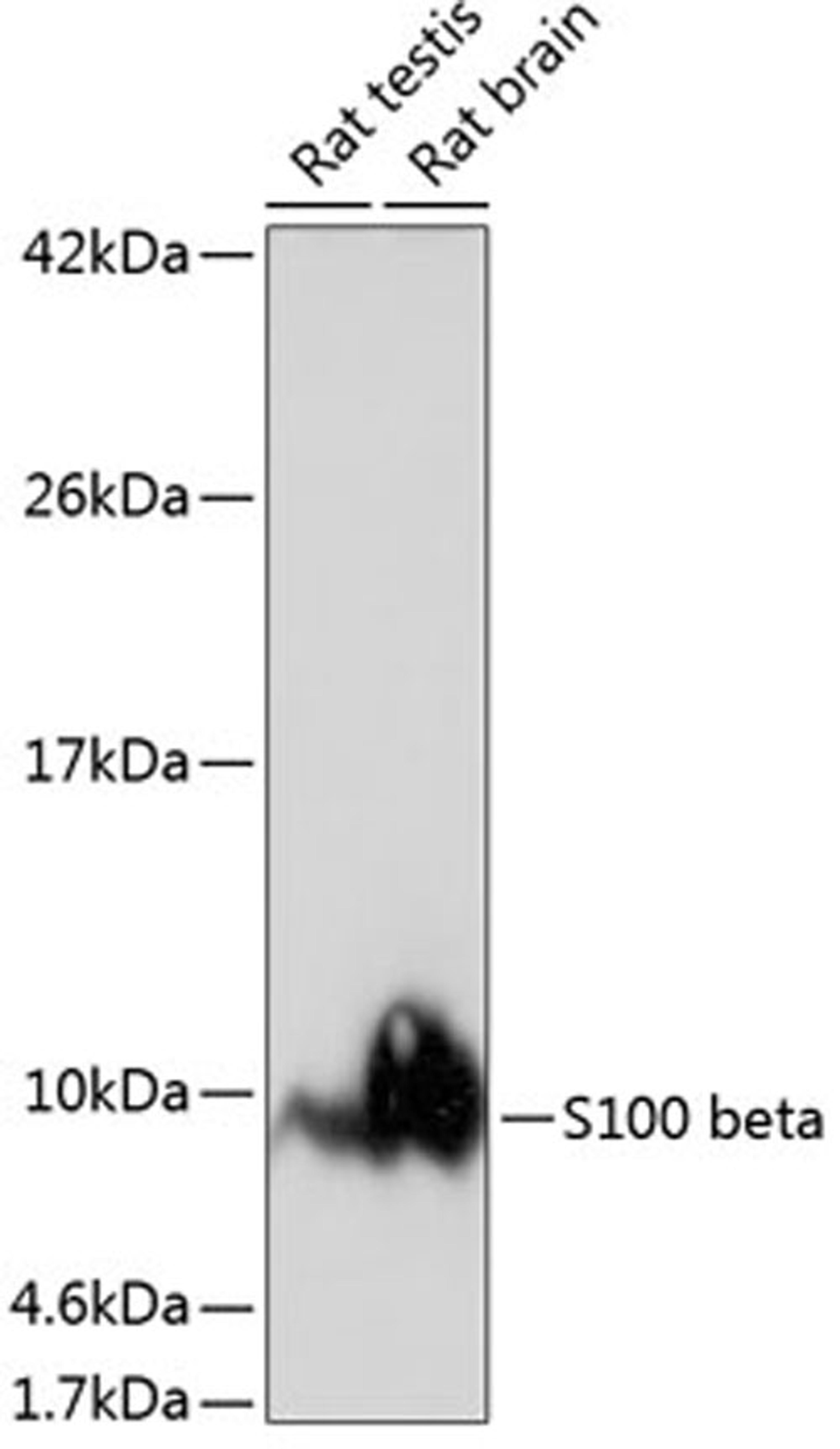 Western blot - S100 beta antibody (A19108)