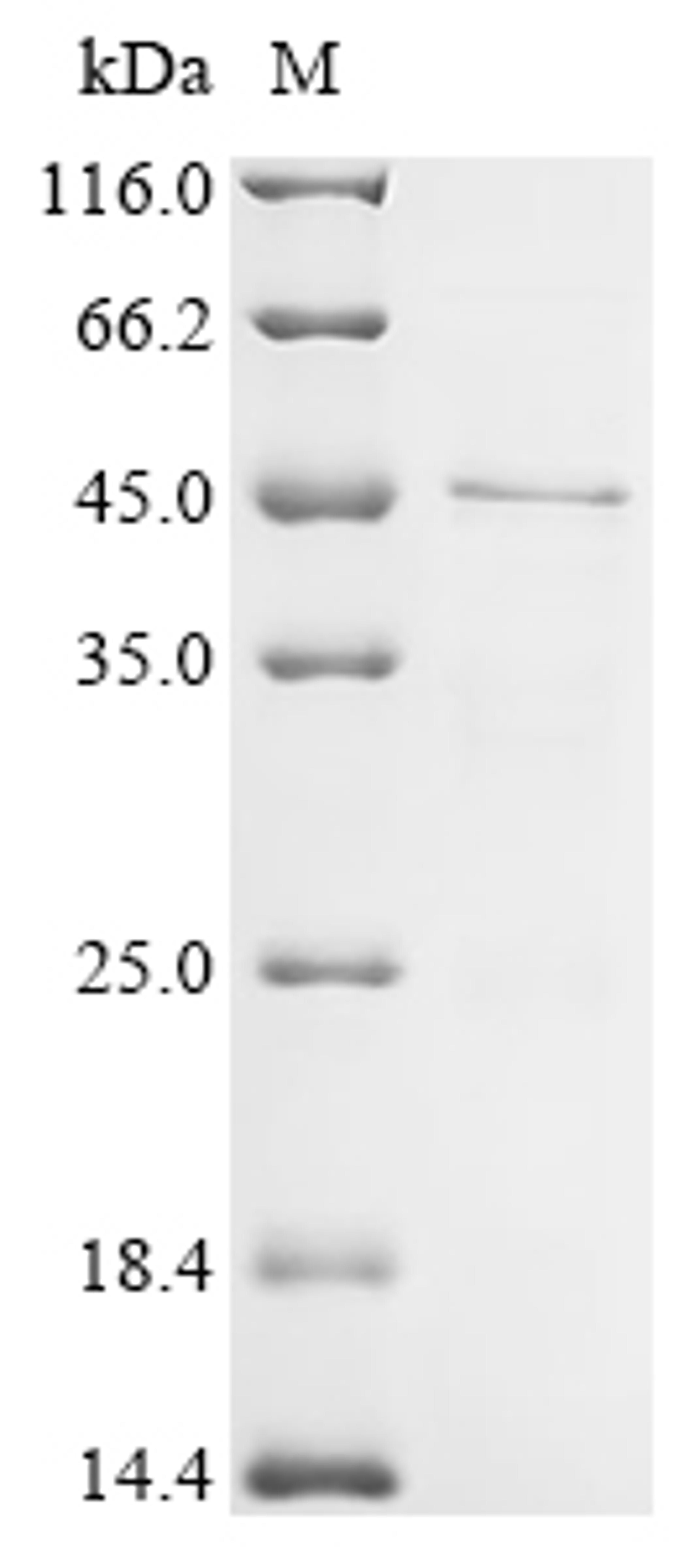 (Tris-Glycine gel) Discontinuous SDS-PAGE (reduced) with 5% enrichment gel and 15% separation gel.