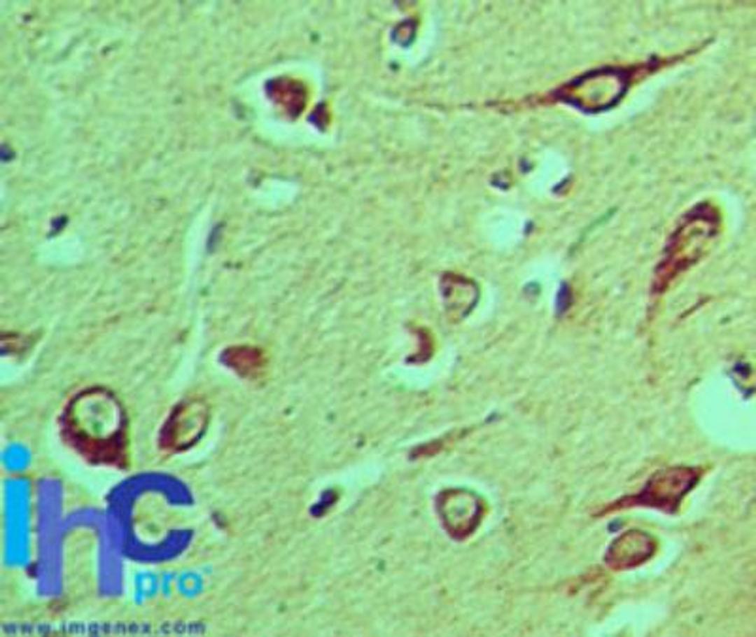 Immunohistochemistry-Paraffin: NLRX1 Antibody [NBP2-27198] - Formalin-fixed, paraffin-embedded human brain stained with NLRX1 antibody at 5 ug/ml. Staining of formalin-fixed tissues is enhanced by boiling tissue sections in 10 mM sodium citrate buffer, pH 6.0 for 10-20 min followed by cooling at RT for 20 min.