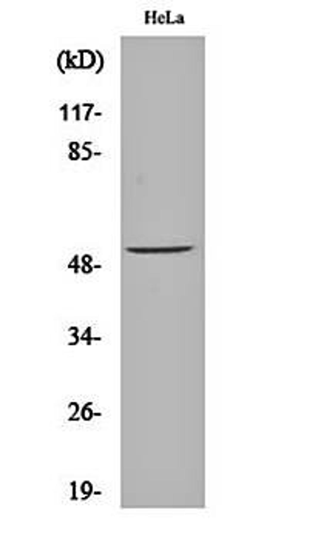 Western blot analysis of Hela cell lysates using ATF-2 (phospho-S62) antibody