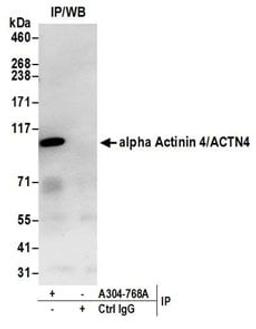 Detection of human alpha Actinin 4/ACTN4 by western blot of immunoprecipitates.