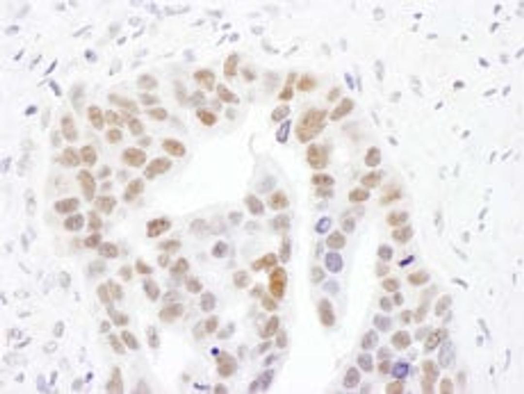 Detection of human NMNAT1 by immunohistochemistry.