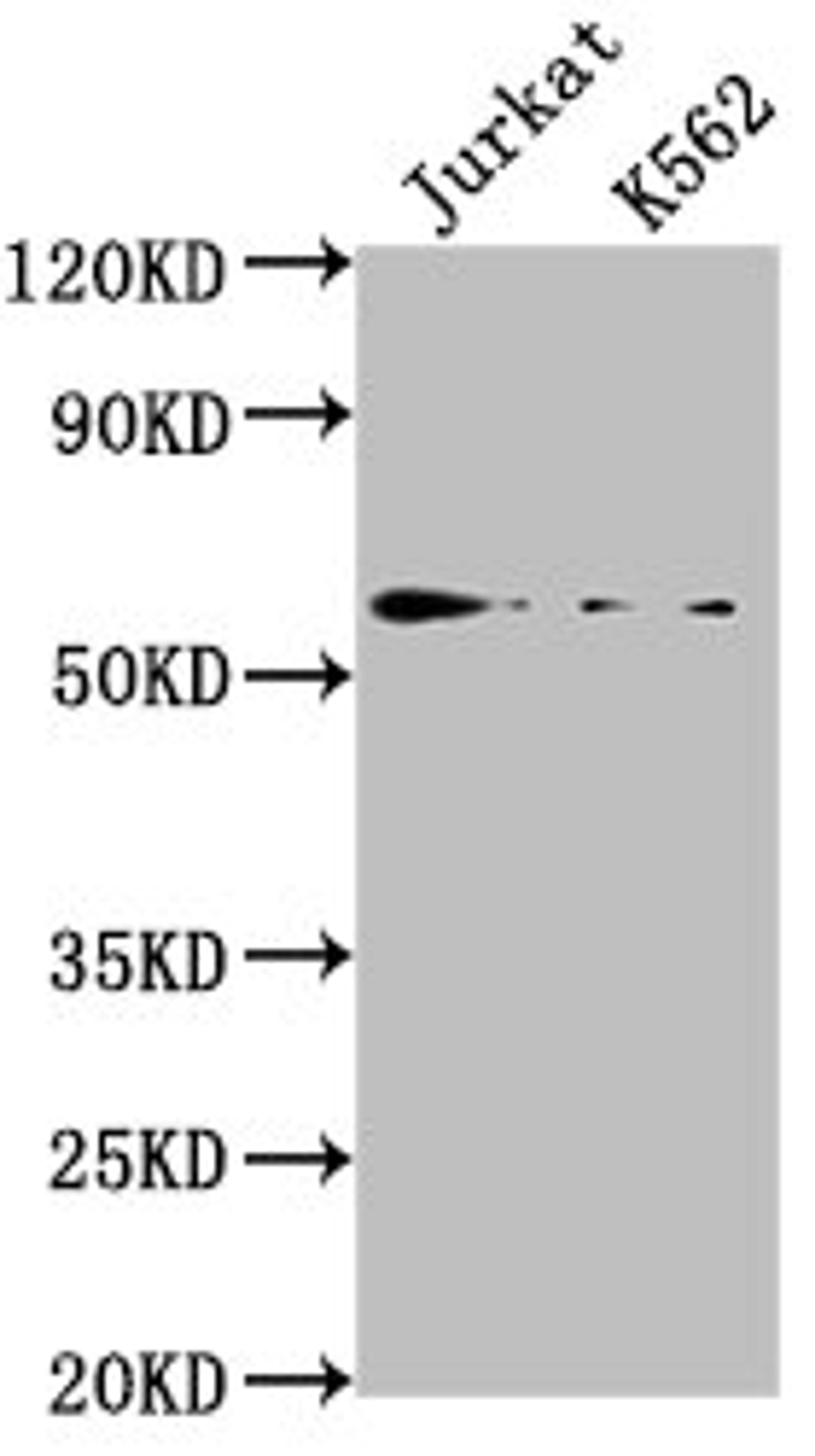Western Blot. Positive WB detected in: Jurkat whole cell lysate, K562 whole cell lysate. All lanes: HMGXB4 antibody at 1:2000. Secondary. Goat polyclonal to rabbit IgG at 1/50000 dilution. Predicted band size: 66 kDa. Observed band size: 66 kDa.