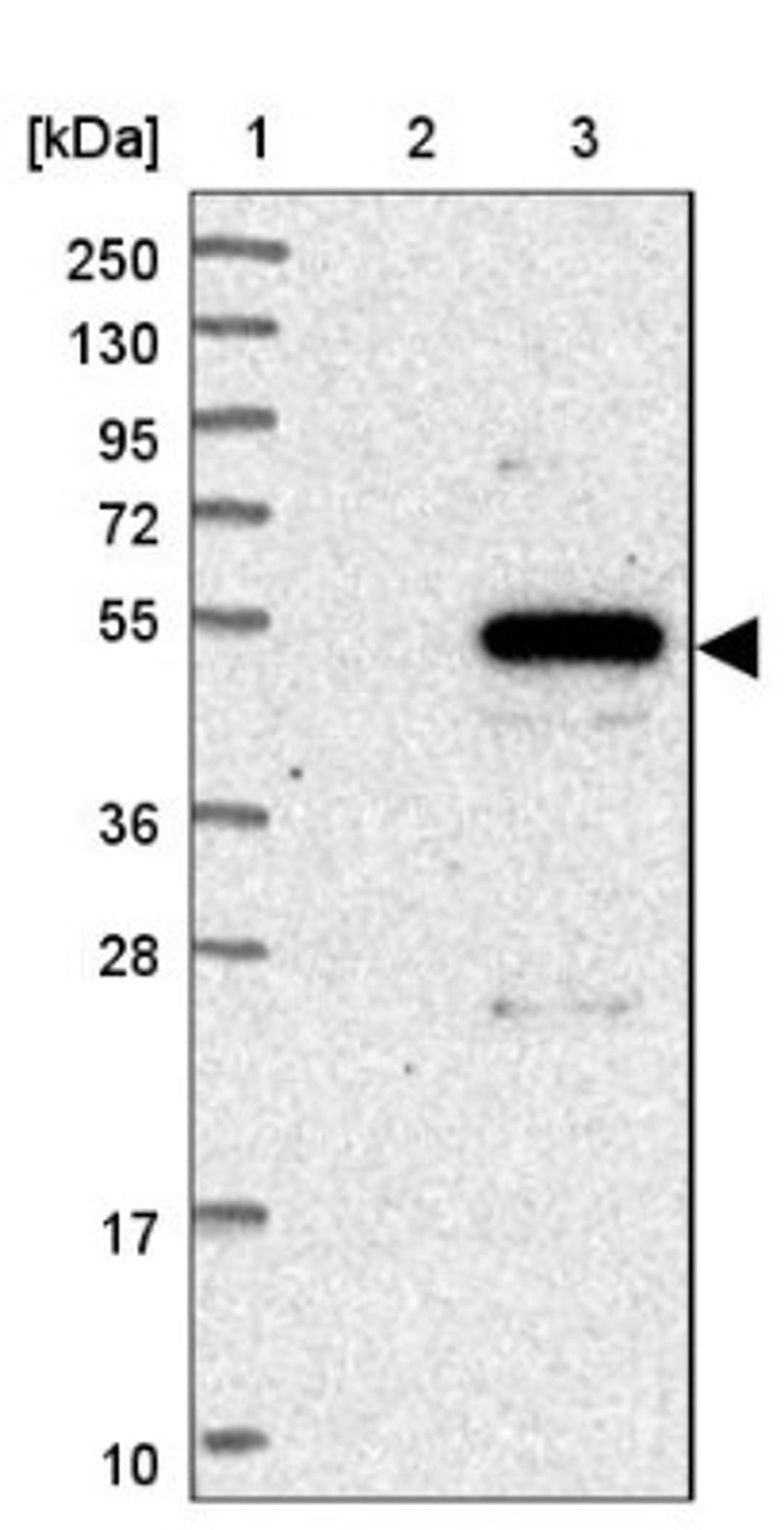 Western Blot: FAM222A Antibody [NBP1-82225] - Lane 1: Marker [kDa] 250, 130, 95, 72, 55, 36, 28, 17, 10<br/>Lane 2: Human cell line RT-4<br/>Lane 3: Human cell line U-251MG sp