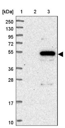 Western Blot: FAM222A Antibody [NBP1-82225] - Lane 1: Marker [kDa] 250, 130, 95, 72, 55, 36, 28, 17, 10<br/>Lane 2: Human cell line RT-4<br/>Lane 3: Human cell line U-251MG sp