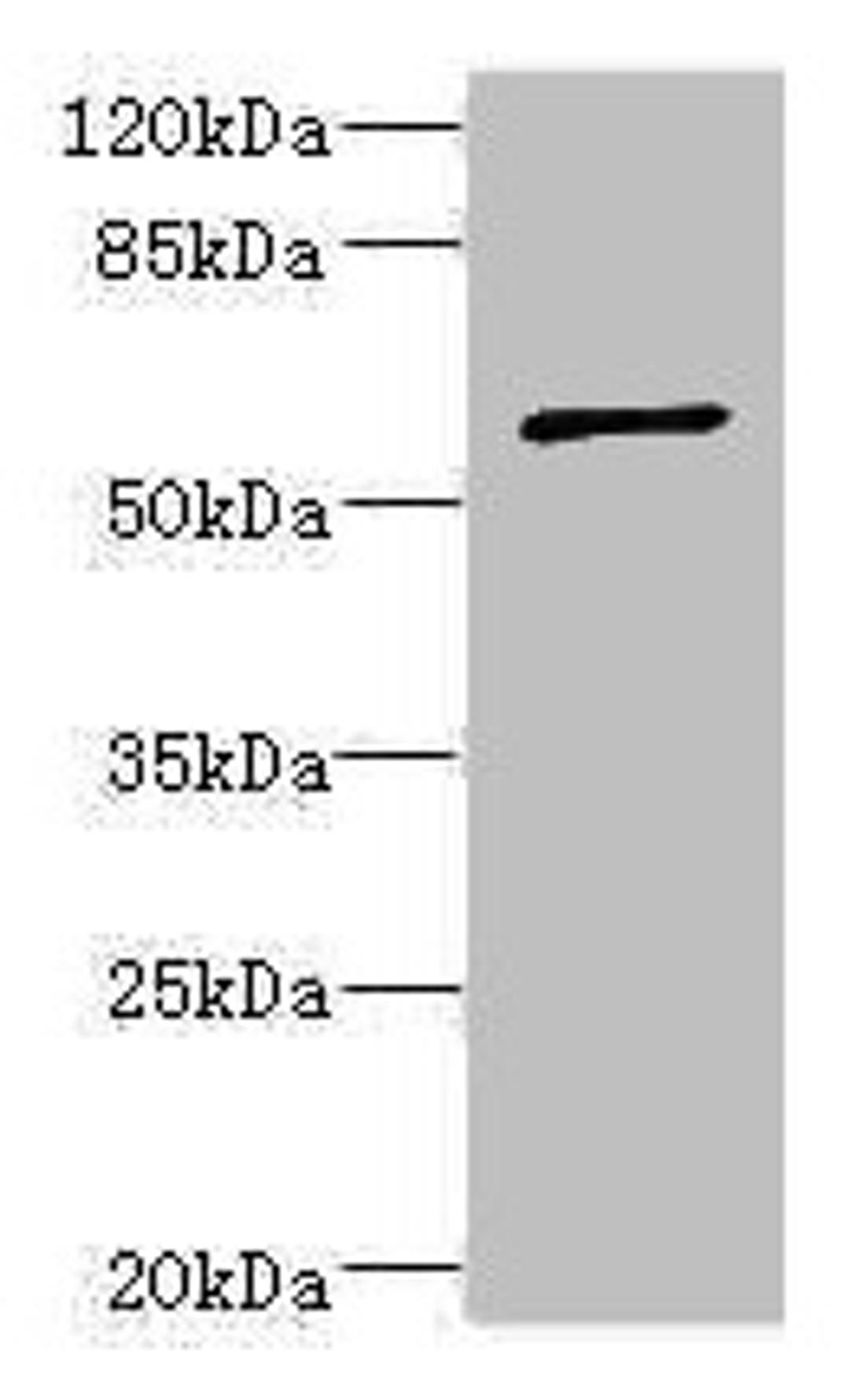 Western blot. All lanes: TBCE antibody at 5.55µg/ml + CEM whole cell lysate. Secondary. Goat polyclonal to rabbit IgG at 1/10000 dilution. Predicted band size: 60, 65 kDa. Observed band size: 60 kDa