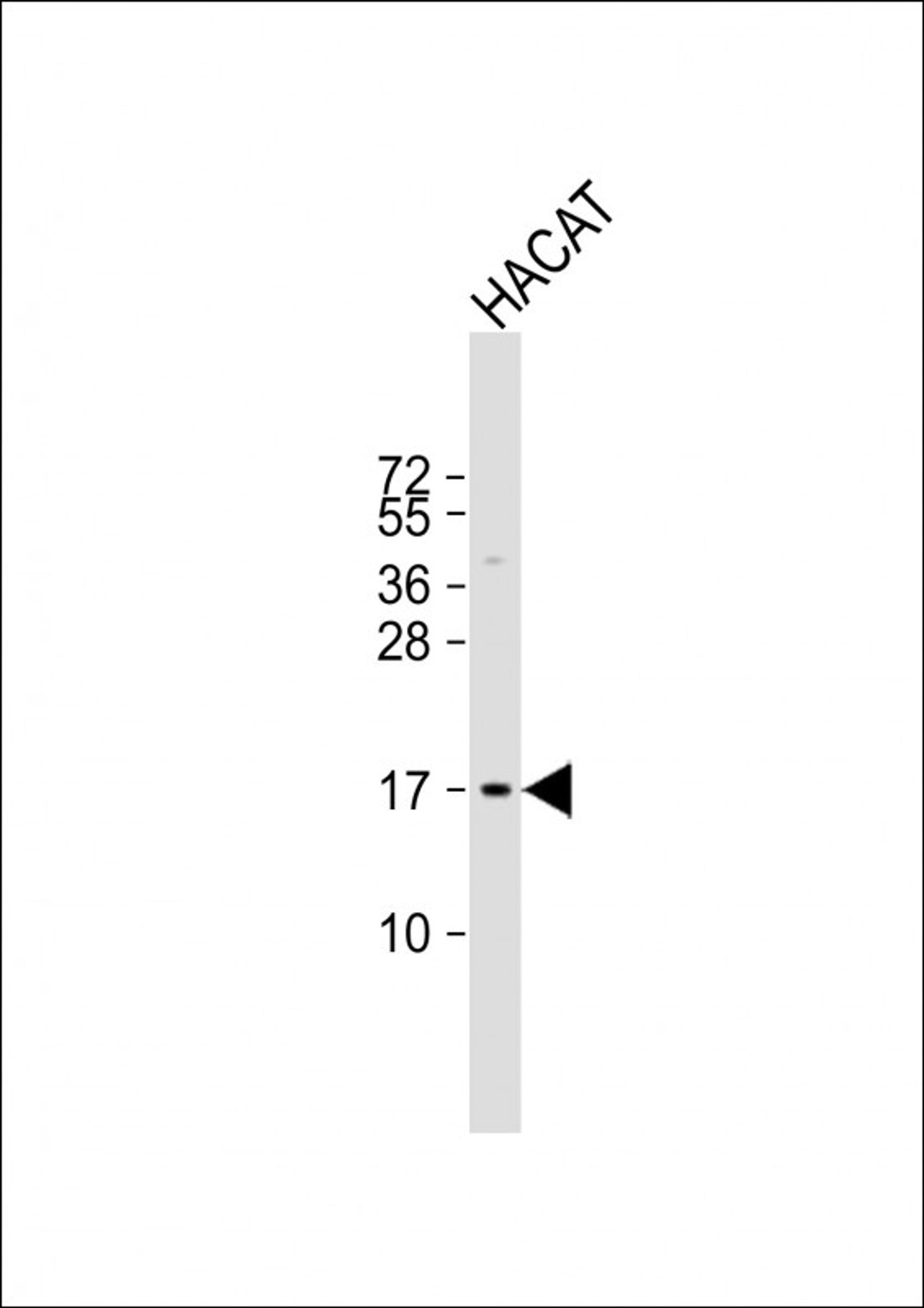 Western Blot at 1:1000 dilution + HACAT whole cell lysate Lysates/proteins at 20 ug per lane.