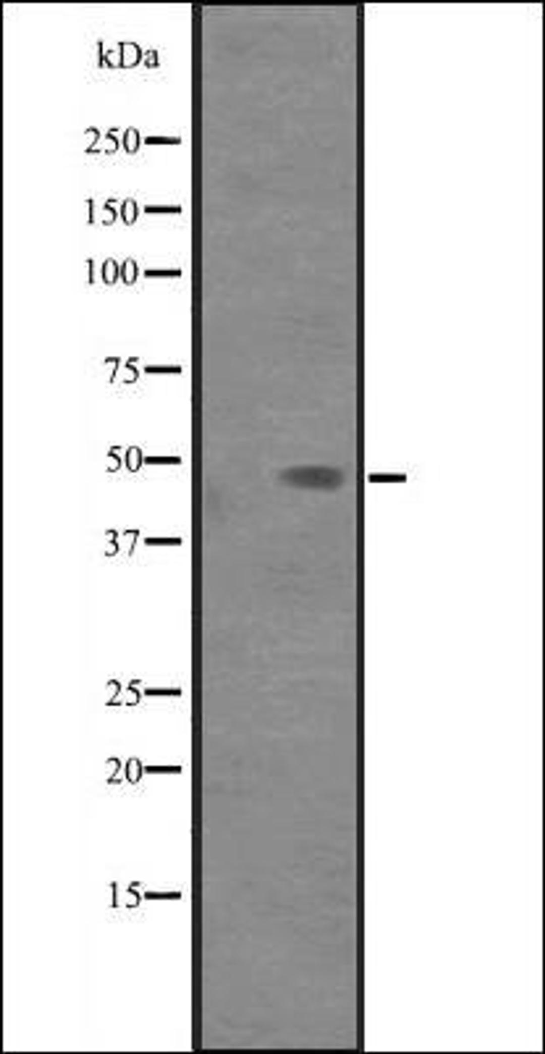 Western blot analysis of 293T cell lysate using PAK1IP1 antibody