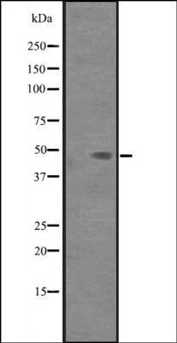 Western blot analysis of 293T cell lysate using PAK1IP1 antibody