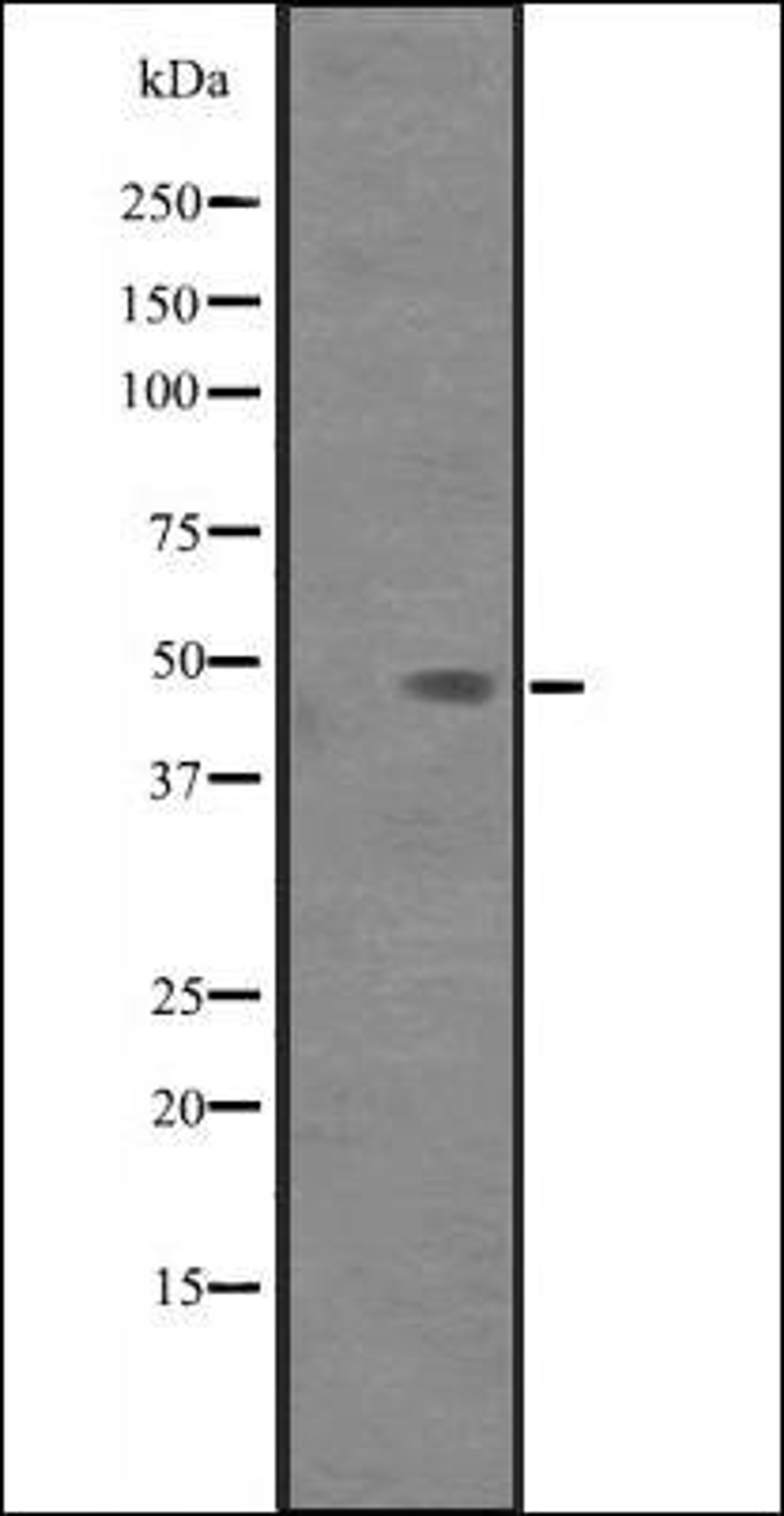 Western blot analysis of 293T cell lysate using PAK1IP1 antibody