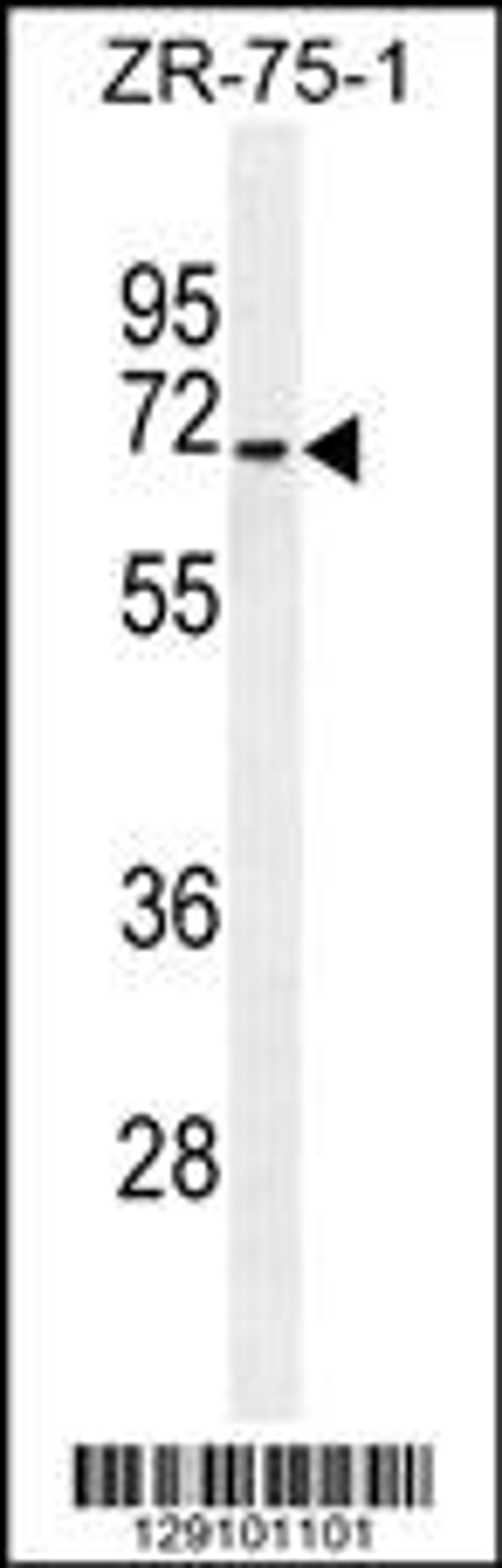 Western blot analysis in ZR-75-1 cell line lysates (35ug/lane).