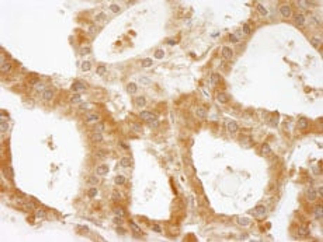 Detection of human CC2D1A by immunohistochemistry.