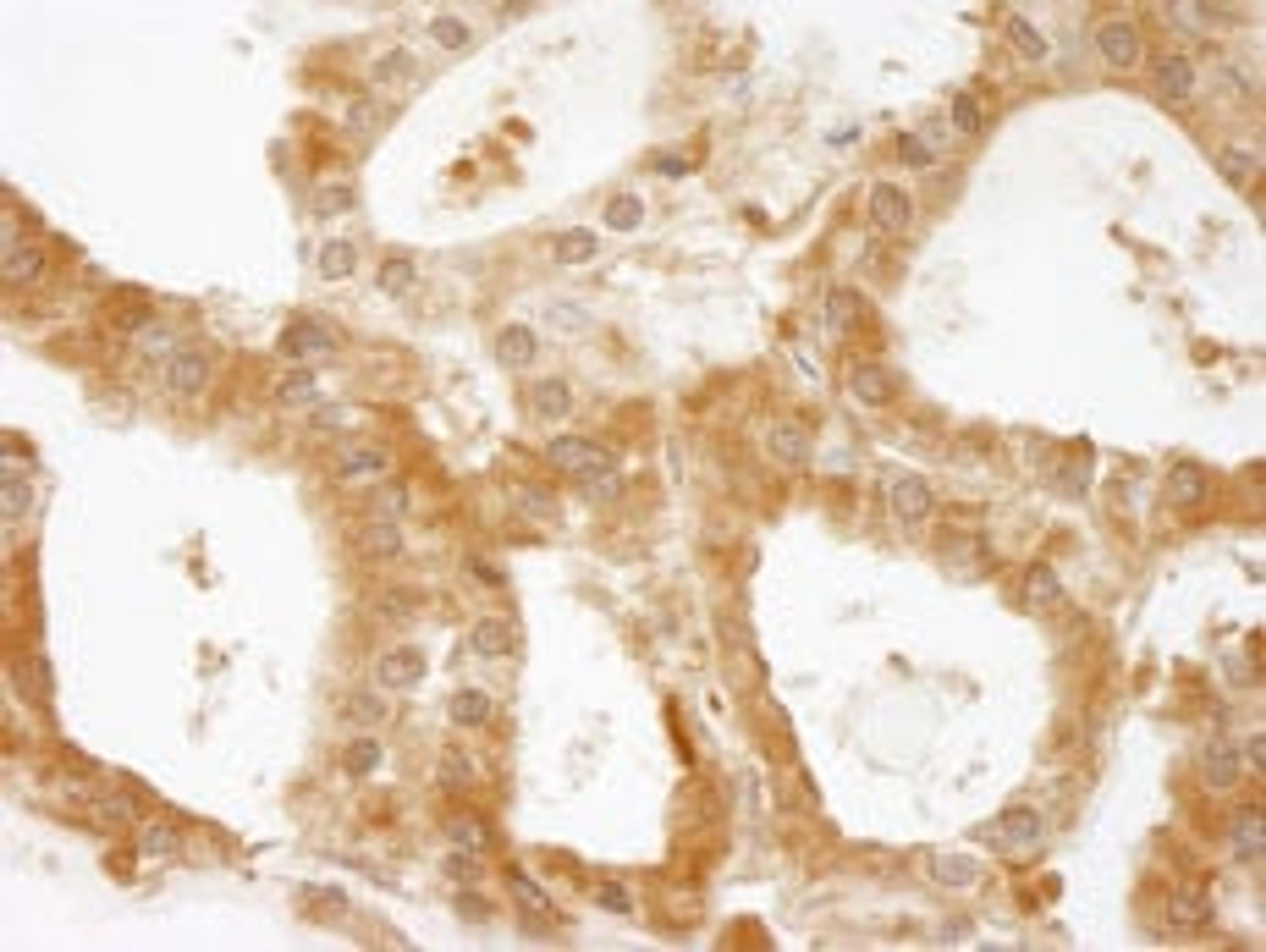 Detection of human CC2D1A by immunohistochemistry.