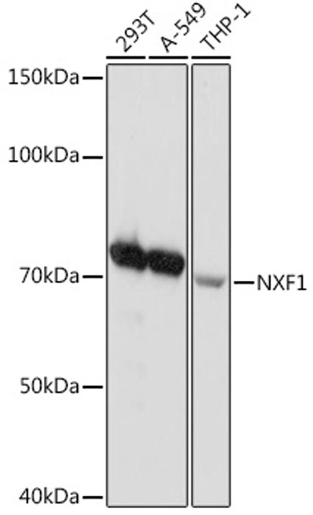 Western blot - NXF1 Rabbit mAb (A3488)