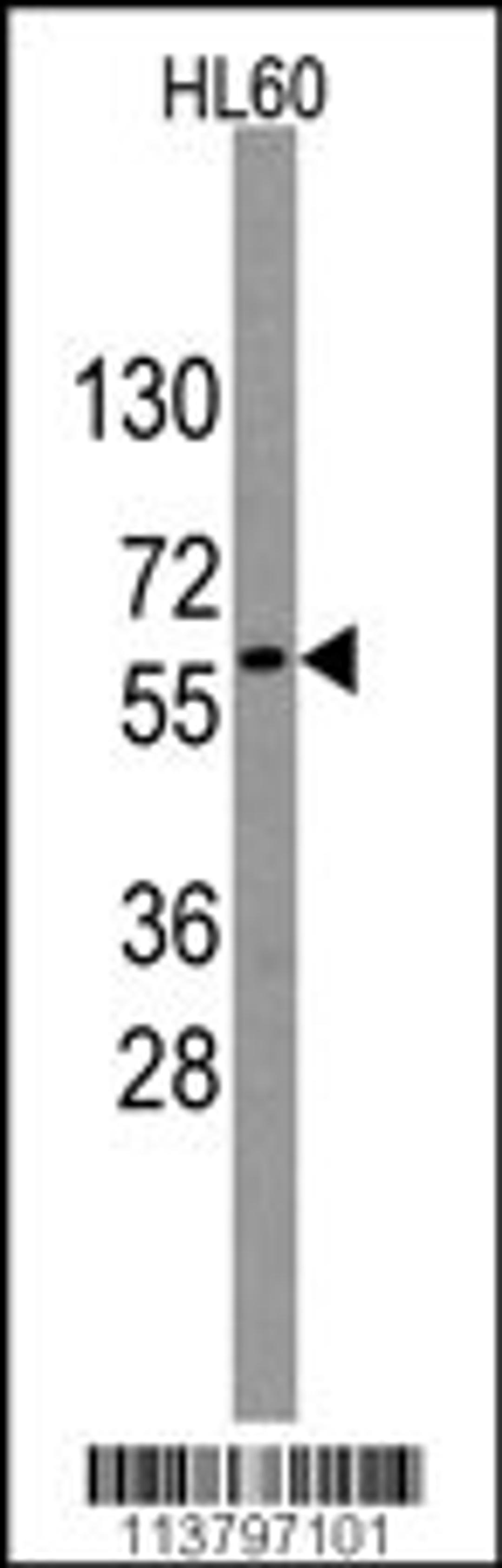 Western blot analysis of anti-GNL3 Antibody in HL60 cell line lysates (35ug/lane)