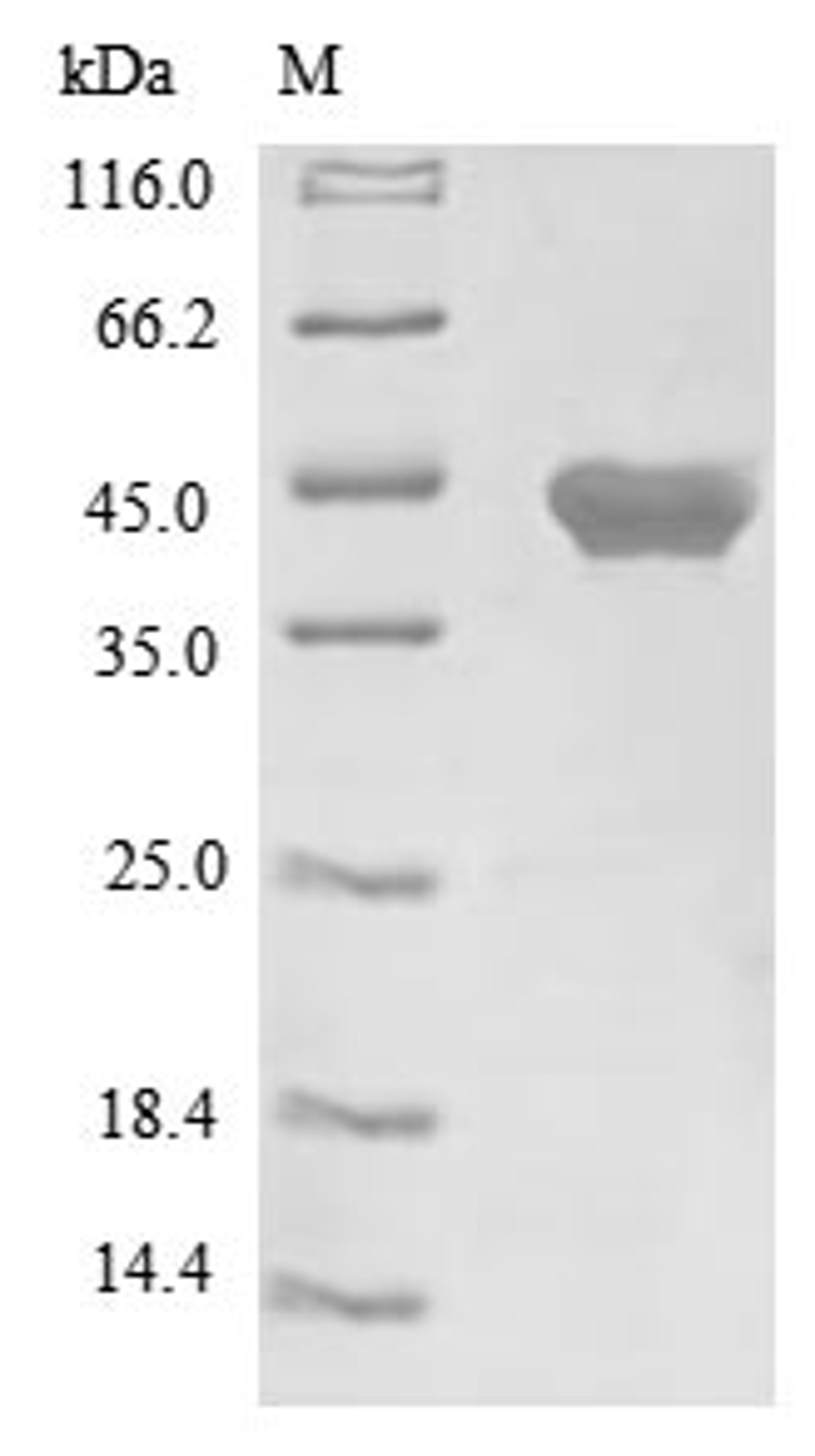 (Tris-Glycine gel) Discontinuous SDS-PAGE (reduced) with 5% enrichment gel and 15% separation gel.