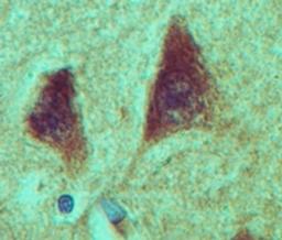 Immunohistochemistry-Paraffin: NANOS1 Antibody [NBP2-27084] - analysis of NANOS1 in formalin-fixed, paraffin-embedded human brain tissue using this antibody at 5 ug/ml.