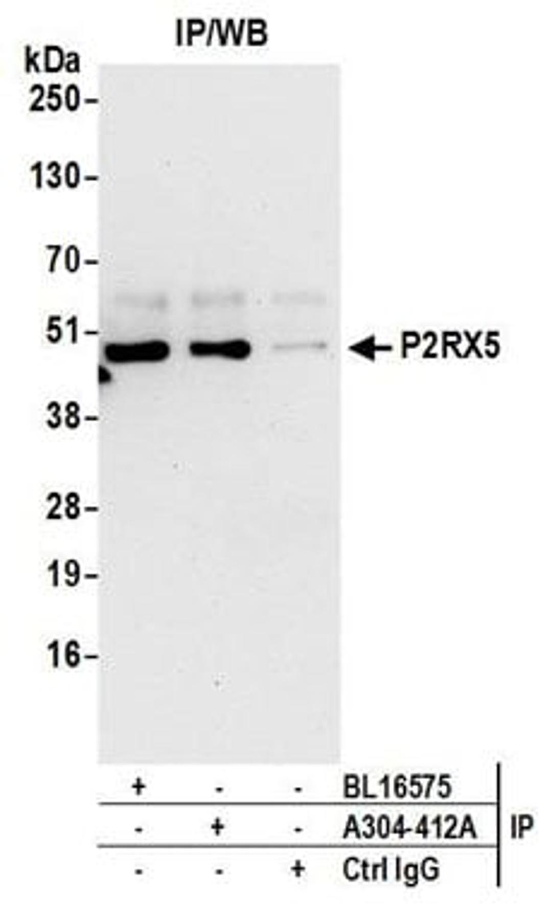 Detection of human P2RX5 by western blot of immunoprecipitates.