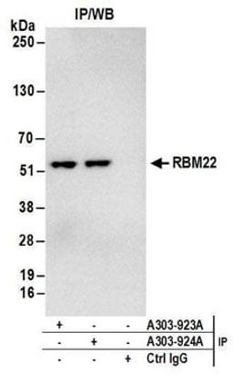 Detection of human RBM22 by western blot of immunoprecipitates.