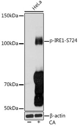 Western blot - Phospho-IRE1-S724 Rabbit mAb (AP1146)