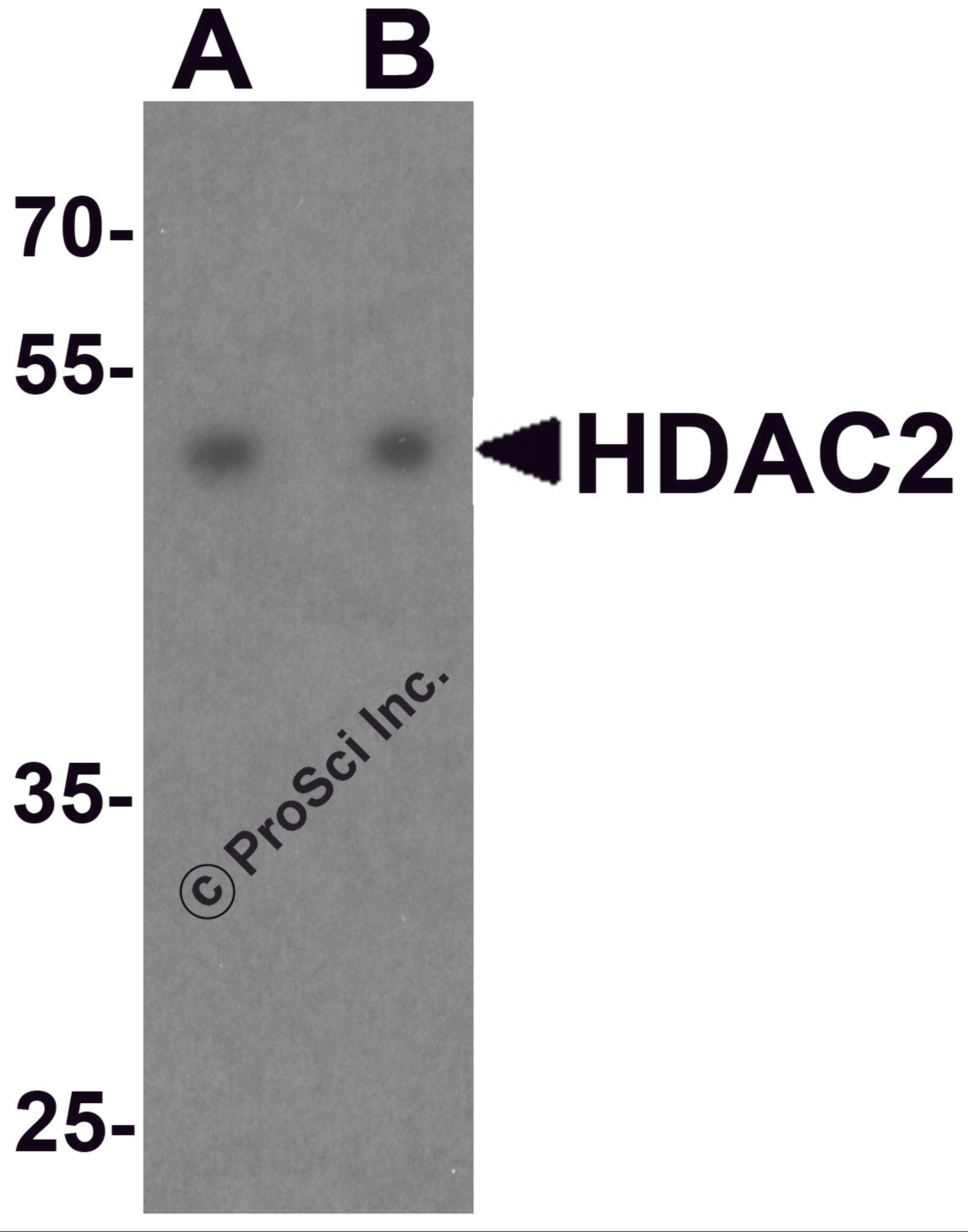 Western blot analysis of HDAC2 in HeLa cell lysate with HDAC2 antibody at (A) 0.5 and (B) 1 &#956;g/ml.