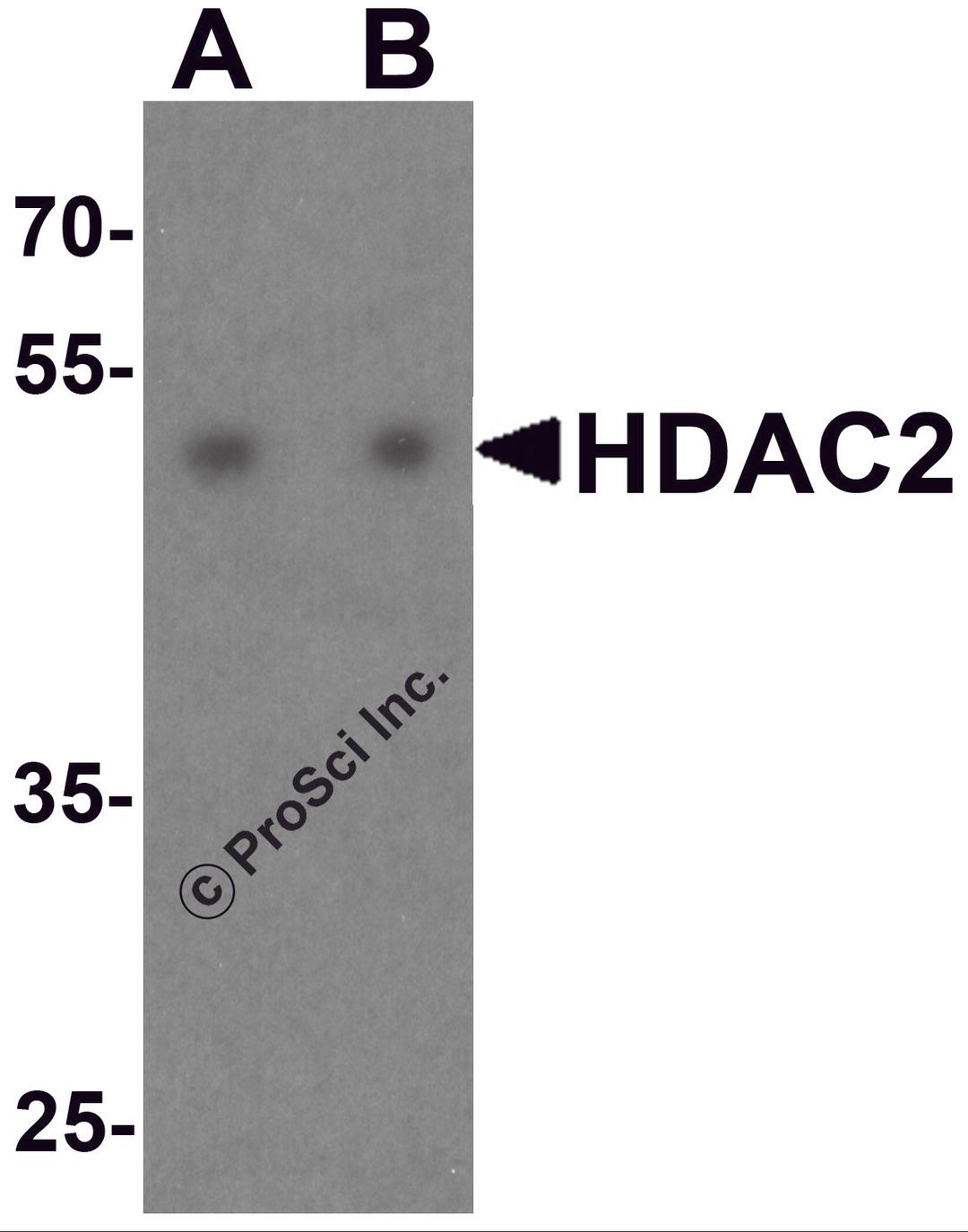 Western blot analysis of HDAC2 in HeLa cell lysate with HDAC2 antibody at (A) 0.5 and (B) 1 μg/ml.