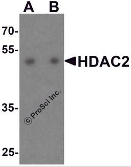 Western blot analysis of HDAC2 in HeLa cell lysate with HDAC2 antibody at (A) 0.5 and (B) 1 μg/ml.